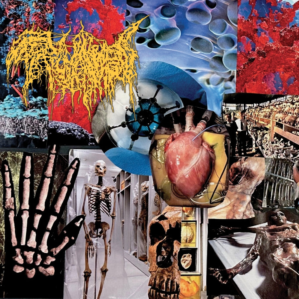 Trichomoniasis - Harvest Of The Killing Fields - CD - New Standard Elite